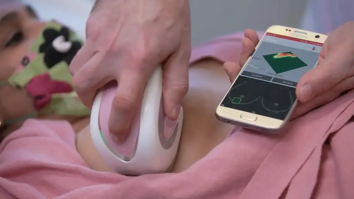 Estudio de cáncer de mama con Ibreastexam
